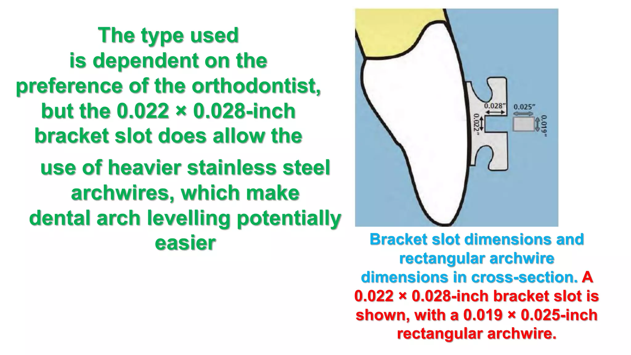 Orthodontic alignment phase of pre-adjusted fixed appliance PART 1 | PPTX