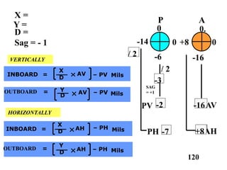 120
X =
Y =
D =
Sag = - 1
-16AV
P
0
0 0
0.
A
-14
-16
+8
-6
SAG
= +1
-2
-3
/ 2
PV
AH+8-7PH
/ 2
VERTICALLY
INBOARD
X
D
AV – PV Mils=
HORIZONTALLY
INBOARD
X
D
AH – PH Mils=
OUTBOARD =
Y
D
AH – PH Mils
OUTBOARD =
D
AV – PV Mils
Y
 