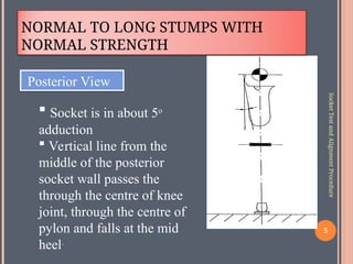 Alignment of Transfemoral prosthesis, TF | PPT