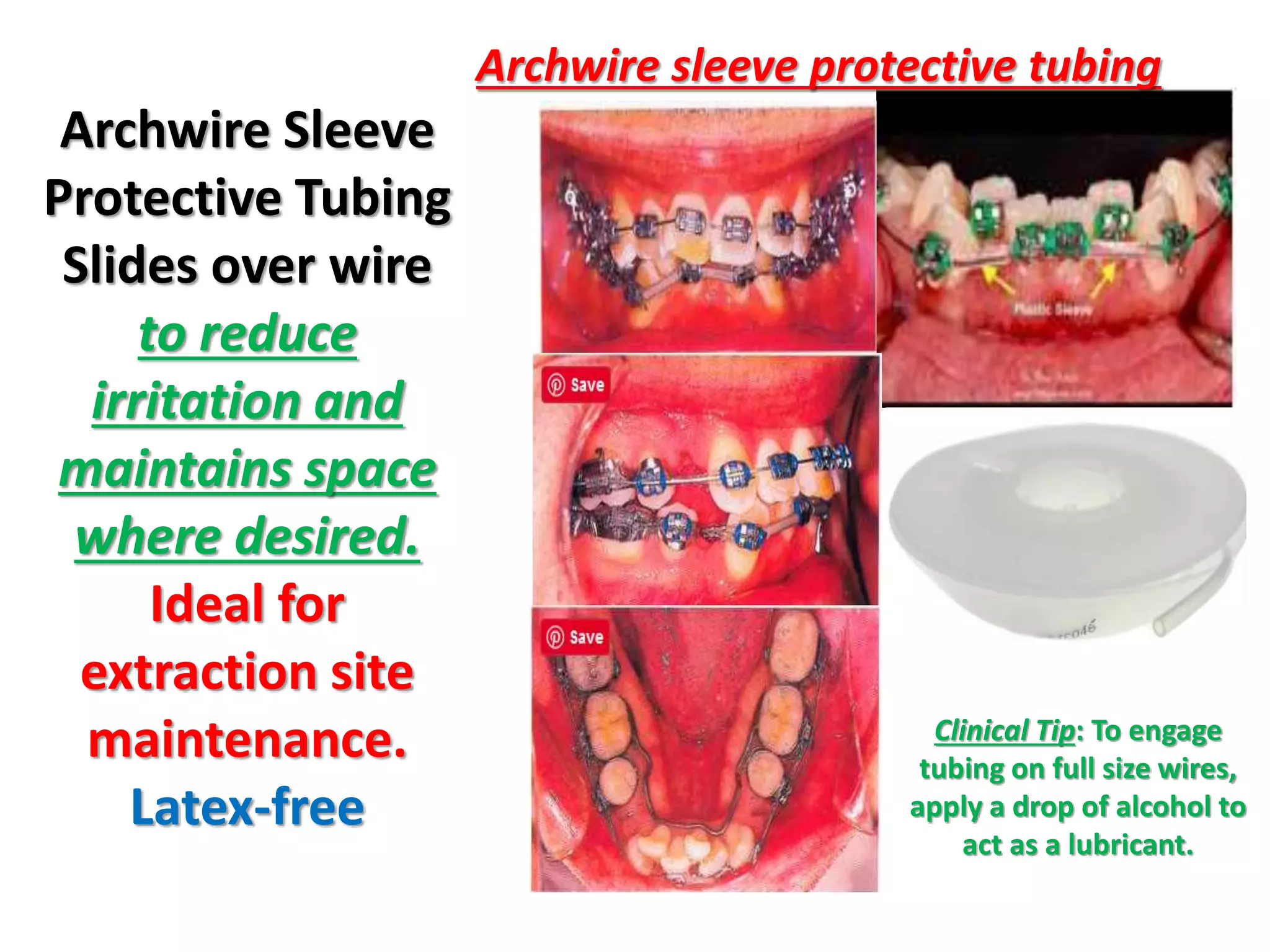 orthodontic alignment of teeth part 3 | PPTX
