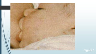 Figura 1
 