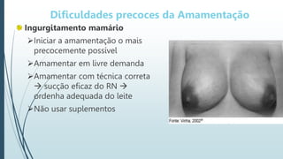 Dificuldades precoces da Amamentação
Ingurgitamento mamário
Iniciar a amamentação o mais
precocemente possível
Amamentar em livre demanda
Amamentar com técnica correta
 sucção eficaz do RN 
ordenha adequada do leite
Não usar suplementos
 