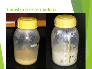 Calostro e leite maduro
 