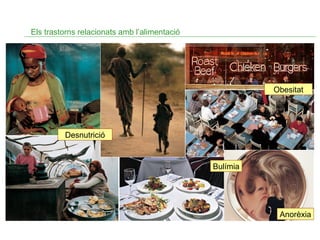 Els trastorns relacionats amb l’alimentació

Obesitat

Desnutrició

Bulímia

Anorèxia

 