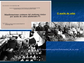 O aceite de colzaO aceite de colza
http://es.wikipedia.org/wiki/Enfermedad_de_la_colza
 