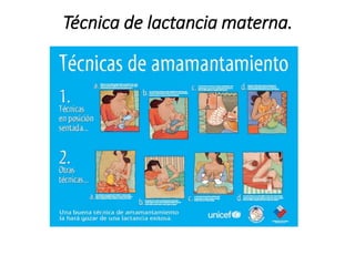 Técnica de lactancia materna.
 