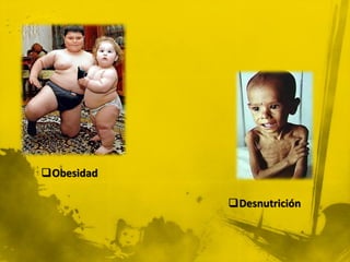 Obesidad

            Desnutrición
 
