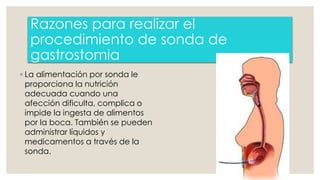 Razones para realizar el 
procedimiento de sonda de 
gastrostomia 
◦ La alimentación por sonda le 
proporciona la nutrición 
adecuada cuando una 
afección dificulta, complica o 
impide la ingesta de alimentos 
por la boca. También se pueden 
administrar líquidos y 
medicamentos a través de la 
sonda. 
 