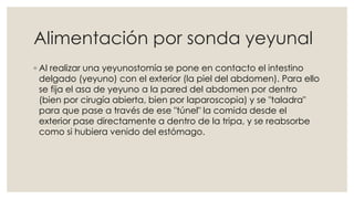 Alimentación por sonda yeyunal 
◦ Al realizar una yeyunostomía se pone en contacto el intestino 
delgado (yeyuno) con el exterior (la piel del abdomen). Para ello 
se fija el asa de yeyuno a la pared del abdomen por dentro 
(bien por cirugía abierta, bien por laparoscopia) y se "taladra" 
para que pase a través de ese "túnel" la comida desde el 
exterior pase directamente a dentro de la tripa, y se reabsorbe 
como si hubiera venido del estómago. 
