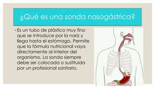 ¿Qué es una sonda nasogástrica? 
◦ Es un tubo de plástico muy fino 
que se introduce por la nariz y 
llega hasta el estómago. Permite 
que la fórmula nutricional vaya 
directamente al interior del 
organismo. La sonda siempre 
debe ser colocada o sustituida 
por un profesional sanitario. 
 