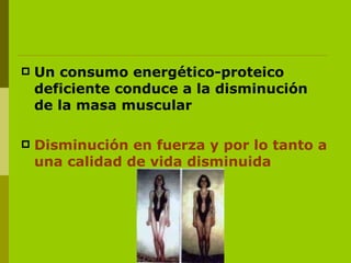 Un consumo energético-proteico deficiente conduce a la disminución de la masa muscular Disminución en fuerza y por lo tanto a una calidad de vida disminuida 