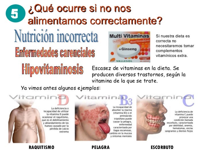 ENFERMEDADES BUCALES La alimentación incorrecta genera problemas en el hueso ENFERMEDADES BUCALES La alimentación incorrecta genera problemas en el hueso