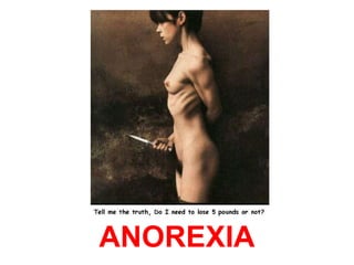 ANOREXIA 