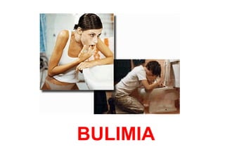 BULIMIA 