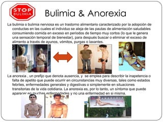 Bulimia & Anorexia
La bulimia o bulimia nerviosa es un trastorno alimentario caracterizado por la adopción de
   conductas...