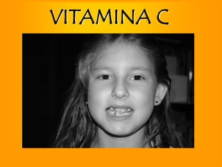 VITAMINA C
 