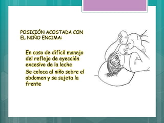 POSICIÓN ACOSTADA CON
EL NIÑO ENCIMA:
En caso de difícil manejo
del reflejo de eyección
excesivo de la leche
Se coloca al niño sobre el
abdomen y se sujeta la
frente
 