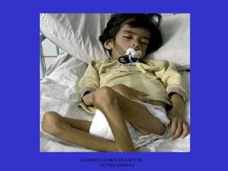 CARMEN GLORIA FRANCO M.
      NUTRICIONISTA
 