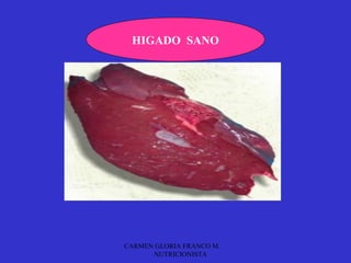 HIGADO SANO




CARMEN GLORIA FRANCO M.
      NUTRICIONISTA
 