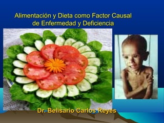 Alimentación y Dieta como Factor CausalAlimentación y Dieta como Factor Causal
de Enfermedad y Deficienciade Enfermedad y Deficiencia
Dr. Belisario Carlos ReyesDr. Belisario Carlos Reyes
 