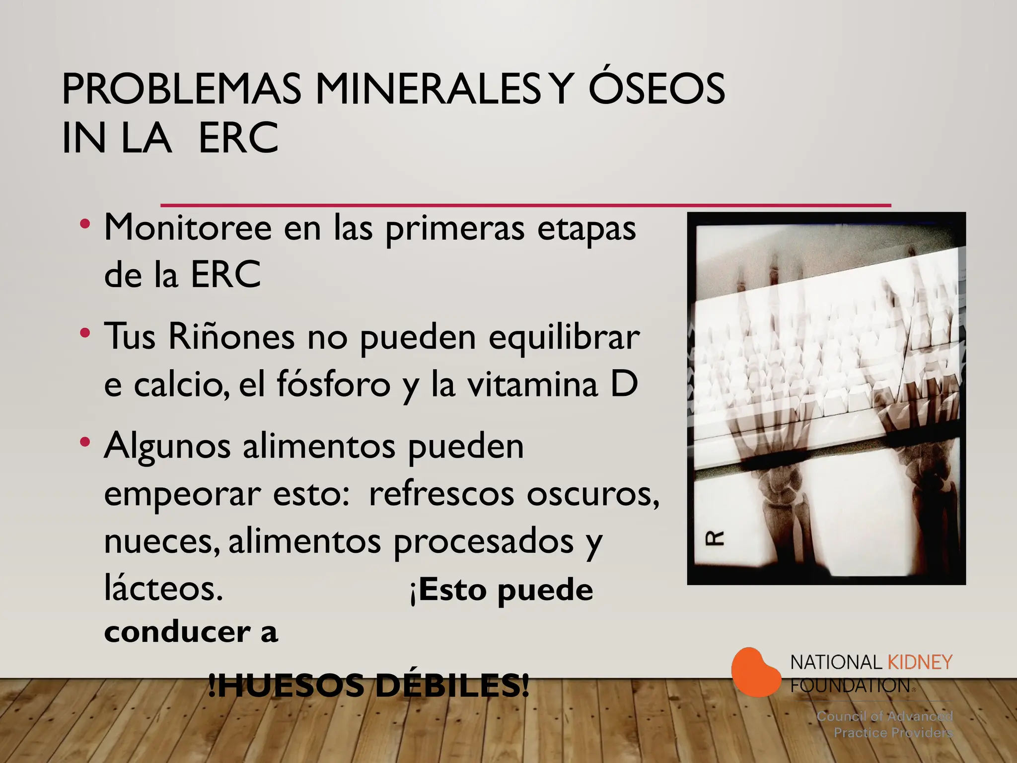 PROBLEMAS MINERALESY ÓSEOS
IN LA ERC
• Monitoree en las primeras etapas
de la ERC
• Tus Riñones no pueden equilibrar
e calcio, el fósforo y la vitamina D
• Algunos alimentos pueden
empeorar esto: refrescos oscuros,
nueces, alimentos procesados y
lácteos. ¡Esto puede
conducer a
!HUESOS DÉBILES!
 