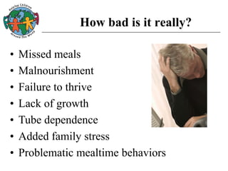 How bad is it really?
• Missed meals
• Malnourishment
• Failure to thrive
• Lack of growth
• Tube dependence
• Added family stress
• Problematic mealtime behaviors
 