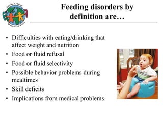 Feeding disorders by
definition are…
• Difficulties with eating/drinking that
affect weight and nutrition
• Food or fluid refusal
• Food or fluid selectivity
• Possible behavior problems during
mealtimes
• Skill deficits
• Implications from medical problems
 