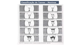 Classificação de Tanner - Meninos
 