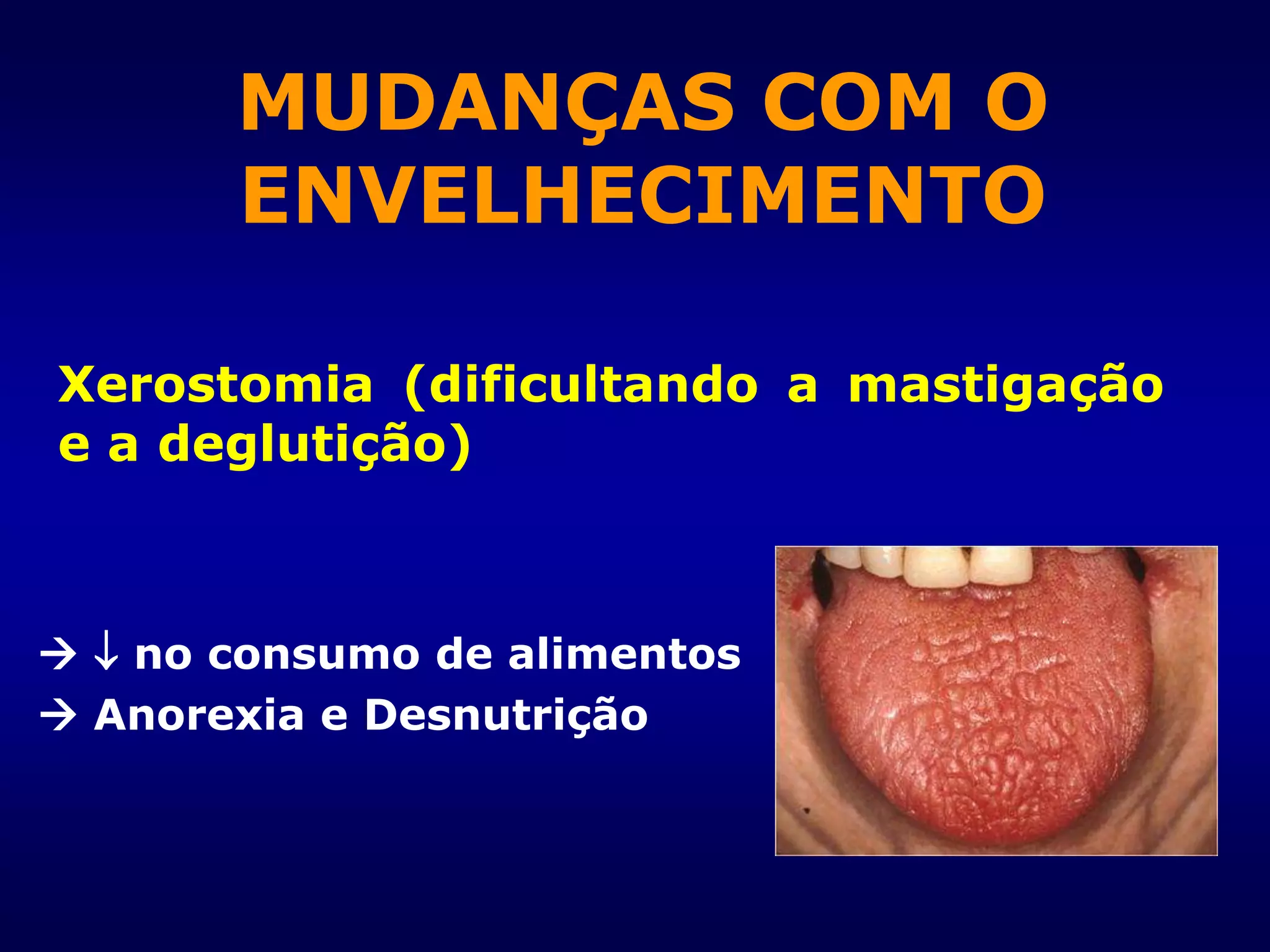 Xerostomia (dificultando a mastigação
e a deglutição)
  no consumo de alimentos
 Anorexia e Desnutrição
MUDANÇAS COM O
ENVELHECIMENTO
 