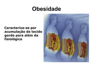 Obesidade


Caracteriza-se por
acumulação de tecido
gordo para além da
fisiológica
 