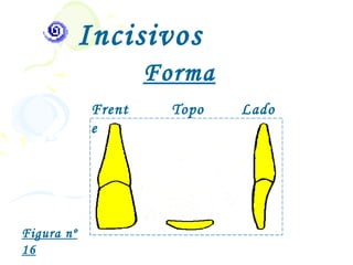 Incisivos
                     Forma
             Frent     Topo   Lado
             e




Figura nº
16
 