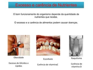 Excesso e carência de Nutrientes
O bom funcionamento do organismo depende da quantidade de
nutrientes que recebe.
O excesso e a carência de alimentos podem causar doenças.
Obesidade
Excesso de Glícidos e
Lípidos
Escorbuto
Carência de vitaminaC
Raquitismo
Carência de
vitamina D
 