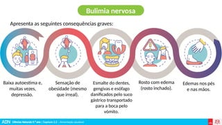 Ciências Naturais 9.º ano | Capítulo 2.2 – Alimentação saudável
Apresenta as seguintes consequências graves:
Bulimia nervosa
Baixa autoestima e,
muitas vezes,
depressão.
Sensação de
obesidade (mesmo
que irreal).
Esmalte do dentes,
gengivas e esófago
danificados pelo suco
gástrico transportado
para a boca pelo
vómito.
Rosto com edema
(rosto inchado).
Edemas nos pés
e nas mãos.
 