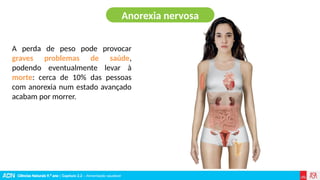 Ciências Naturais 9.º ano | Capítulo 2.2 – Alimentação saudável
A perda de peso pode provocar
graves problemas de saúde,
podendo eventualmente levar à
morte: cerca de 10% das pessoas
com anorexia num estado avançado
acabam por morrer.
Anorexia nervosa
 