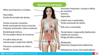 Ciências Naturais 9.º ano | Capítulo 2.2 – Alimentação saudável
Anorexia nervosa
Desmaios frequentes, cansaço e falhas
de memória.
Insónias.
Depressão.
Olhos lacrimejantes e irritados.
Tensão muscular constante.
Perda acentuada de massa muscular.
Fraqueza acentuada e dores corporais.
Mau hálito.
Erosão do esmalte dos dentes.
Desidratação intensa.
Os rins podem deixar de funcionar.
A mulher deixa de ter
menstruação e pode ficar infértil.
Tremores constantes de mãos e
de pés.
Cabelo seco e quebradiço.
Perda acentuada de cabelo.
Pele seca e amarelada.
Tensão baixa e taquicardia (batimentos
rápidos do coração).
Perigo de falha cardíaca.
Obstipação.
Distensão (alargamento) abdominal.
Osteoporose (ossos mais quebradiços).
 