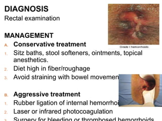DIAGNOSIS
Rectal examination
MANAGEMENT
A. Conservative treatment
1. Sitz baths, stool softeners, ointments, topical
anesthetics.
2. Diet high in fiber/roughage
3. Avoid straining with bowel movements
B. Aggressive treatment
1. Rubber ligation of internal hemorrhoids
2. Laser or infrared photocoagulation
 