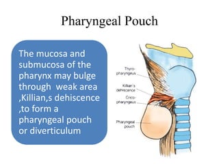 Pharyngeal Pouch
The mucosa and
submucosa of the
pharynx may bulge
through weak area
,Killian,s dehiscence
,to form a
pharyngeal pouch
or diverticulum
 