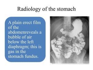 Radiology of the stomach
A plain erect film
of the
abdomenreveals a
bubble of air
below the left
diaphragm; this is
gas in the
stomach fundus.
 
