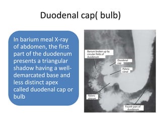 Duodenal cap( bulb)
In barium meal X-ray
of abdomen, the first
part of the duodenum
presents a triangular
shadow having a well-
demarcated base and
less distinct apex
called duodenal cap or
bulb
 