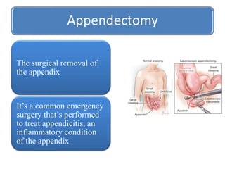 Appendectomy
The surgical removal of
the appendix
It’s a common emergency
surgery that’s performed
to treat appendicitis, an
inflammatory condition
of the appendix
 