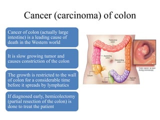 Cancer (carcinoma) of colon
Cancer of colon (actually large
intestine) is a leading cause of
death in the Western world
It is slow growing tumor and
causes constriction of the colon
The growth is restricted to the wall
of colon for a considerable time
before it spreads by lymphatics
If diagnosed early, hemicolectomy
(partial resection of the colon) is
done to treat the patient
 