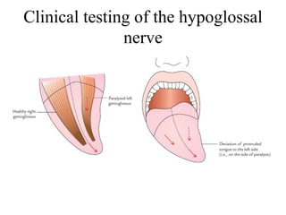 Clinical testing of the hypoglossal
nerve
 
