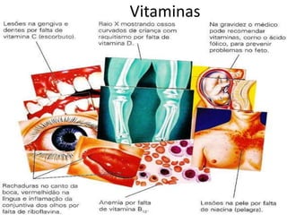 Proteção contra pancadas e choques.