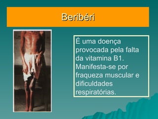 Beribéri É uma doença provocada pela falta da vitamina B1. Manifesta-se por fraqueza muscular e dificuldades respiratórias. 