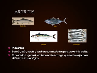 PESCADO Salmón, atún, verdel y sardinas son excelentes para prevenir la artritis.  El pescado en general, contiene aceites omega, que son lo mejor para el Sistema Inmunológico. ARTRITIS Salmón Atún Verdel Sardinas 
