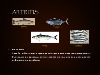 PESCADO Salmón, atún, verdel y sardinas son excelentes para prevenir la artritis.  El pescado en general, contiene aceites omega, que son lo mejor para el Sistema Inmunológico. ARTRITIS Salmón Atún Verdel Sardinas 