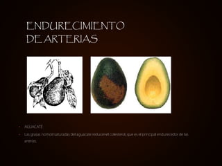 ENDURECIMIENTO
     DE ARTERIAS




•   AGUACATE

•   Las grasas nomoinsaturadas del aguacate reducenel colesterol, que es el principal endurecedor de las
    arterias.
 