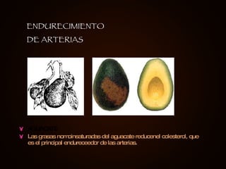 AGUACATE Las grasas nomoinsaturadas del aguacate reducenel colesterol, que es el principal endureceedor de las arterias. ENDURECIMIENTO DE ARTERIAS 