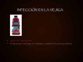 JUGO DE ARÁNDANO El altamente ácido jugo de arándano controla la bacteria perjudicial.  INFECCIÓN EN LA VEJIGA 
