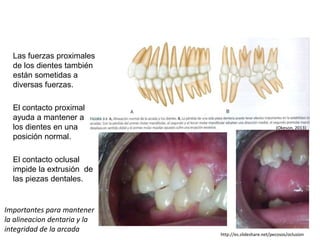 Las fuerzas proximales
de los dientes también
están sometidas a
diversas fuerzas.
El contacto proximal
ayuda a mantener a
los dientes en una
posición normal.
El contacto oclusal
impide la extrusión de
las piezas dentales.
(Okeson, 2013)
http://es.slideshare.net/pecosos/oclusion
Importantes para mantener
la alineacion dentaria y la
integridad de la arcada
 